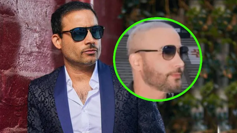 Germán Montero se realiza trasplante capilar tras SENTIRSE “FEO” y ahora se arrepiente