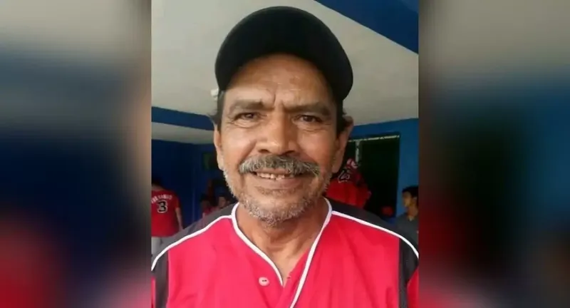 Llaman a solidaridad por salud del ex beisbolista nicaragüense Roberto «Bobby» Espino