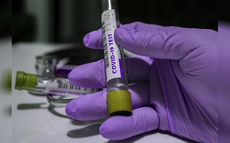 MINSA da a conocer situación del Coronavirus al 07 de julio de 2026