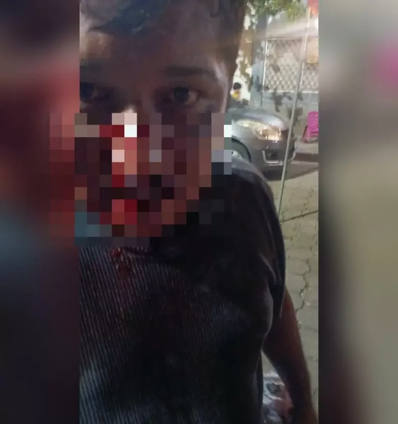 Delincuente hiere a capitalino que defendió a su cuñada en barrio El Recreo