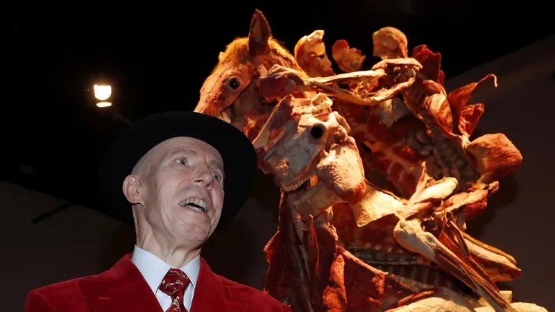 Fallece el ‘Doctor Muerte’, famoso por sus polémicas exposiciones de cadáveres