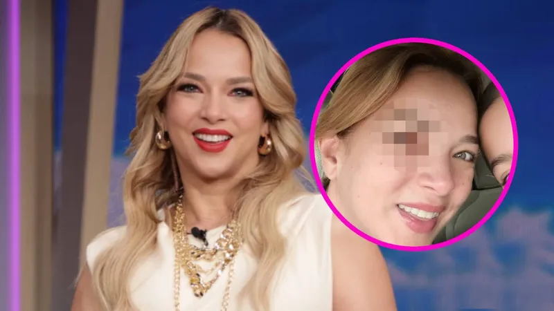 Adamari López alarma tras aparecer con TERRIBLE LESIÓN en el ojo: “me empezó a picar el ojo y me rasqué”