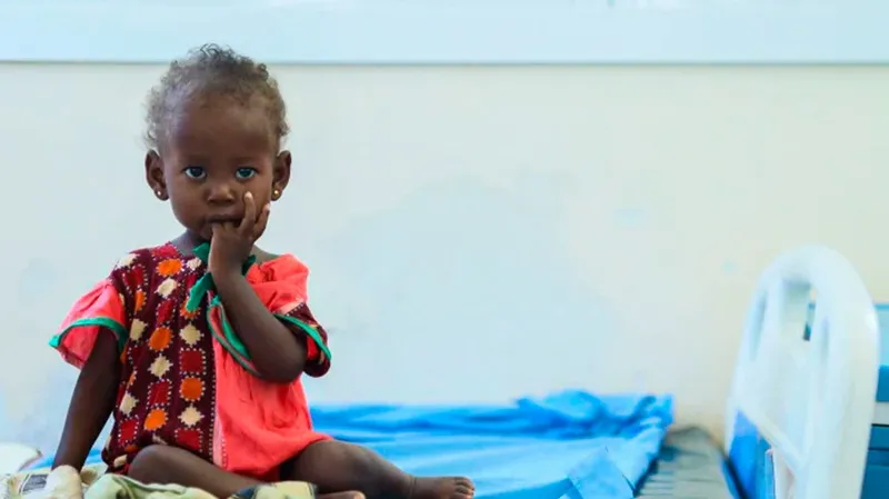 1,9 millones de niños podrían sufrir desnutrición en Somalia