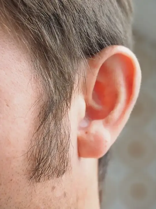 Capitalino casi pierde una oreja por «pleitisto»