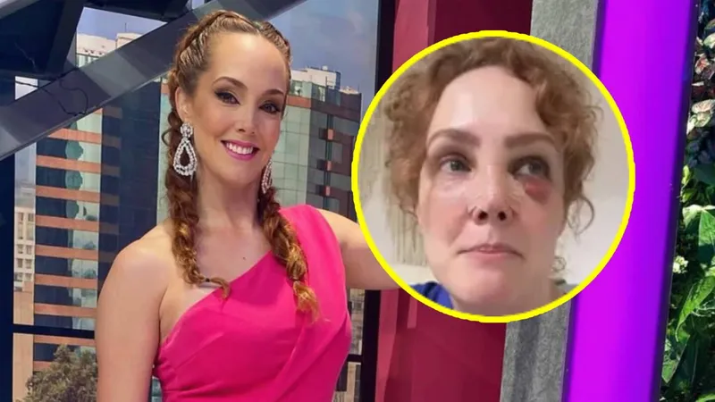¿Qué le pasó a Franc Meric? La esposa de Raúl Sandoval preocupa al mostrarse con un OJO MORADO y heridas