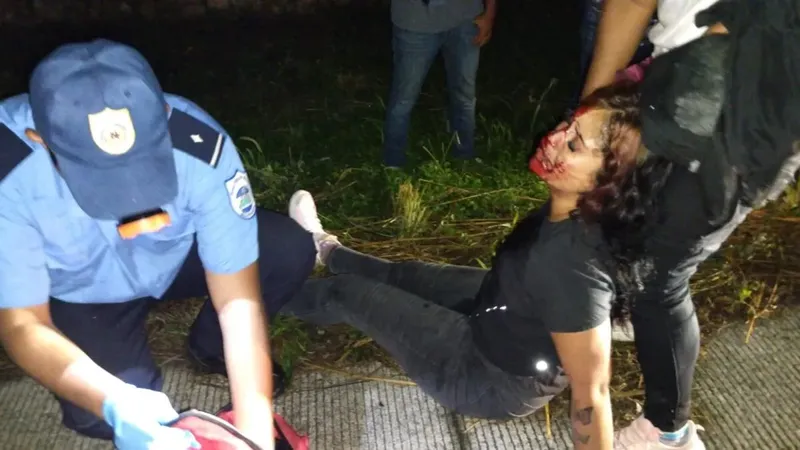 Anielka Salinas resulta lesionada al esquivar un perro en carretera a León