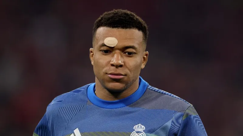 A Mbappé le crecen los enanos también en Francia