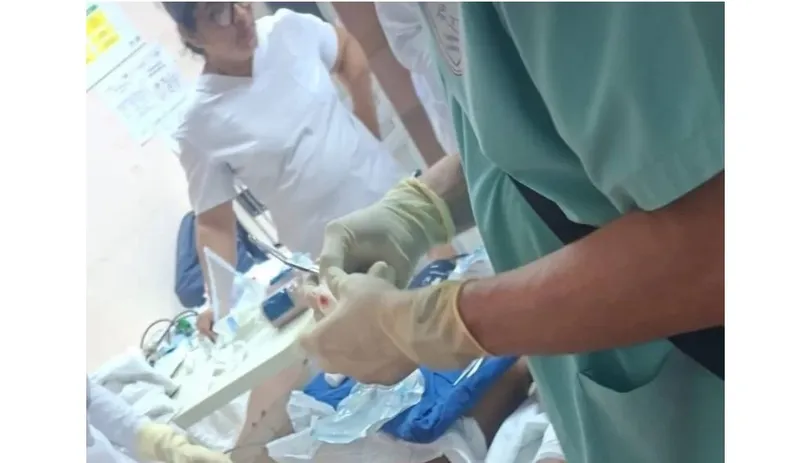 Le amputan la otra mano a joven que sufrió potente descarga eléctrica en El Jícaro, Nueva Segovia