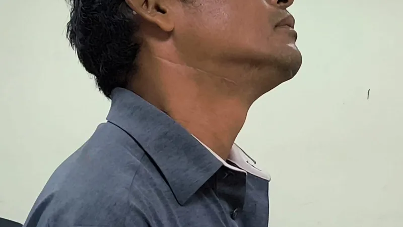 Sujeto enfrenta juicio por intentar degollar a un hombre con un machete en Managua