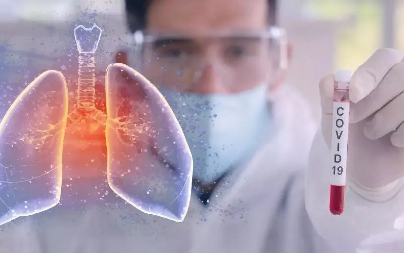 Nicaragua no reporta casos de Covid-19