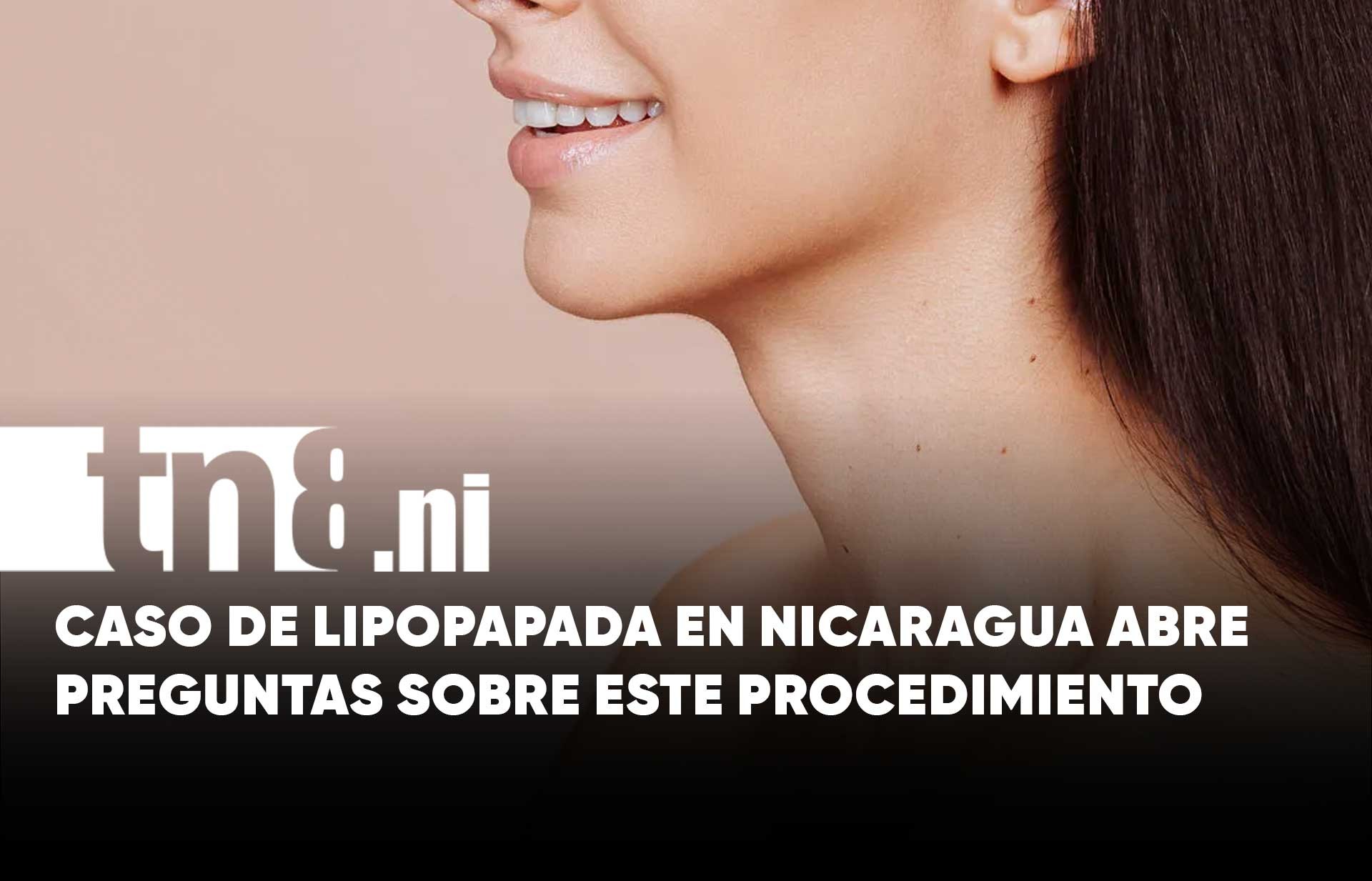 Lo que debés saber sobre la lipopapada tras el caso que llegó a juicio